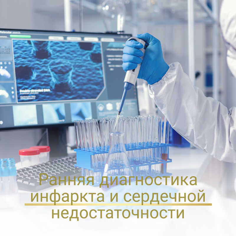 Новое исследование, которое позволяет на ранней стадии диагностировать острый инфаркт миокарда